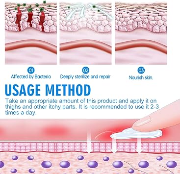 Antibacterial Cream for Private Parts,Anti Itching Crea-m for Private Parts,Can Quickly Relieve Itching and Chapped Feeling and Remove Odor,Antipruritic Cream for Men and Women (30g+20g)