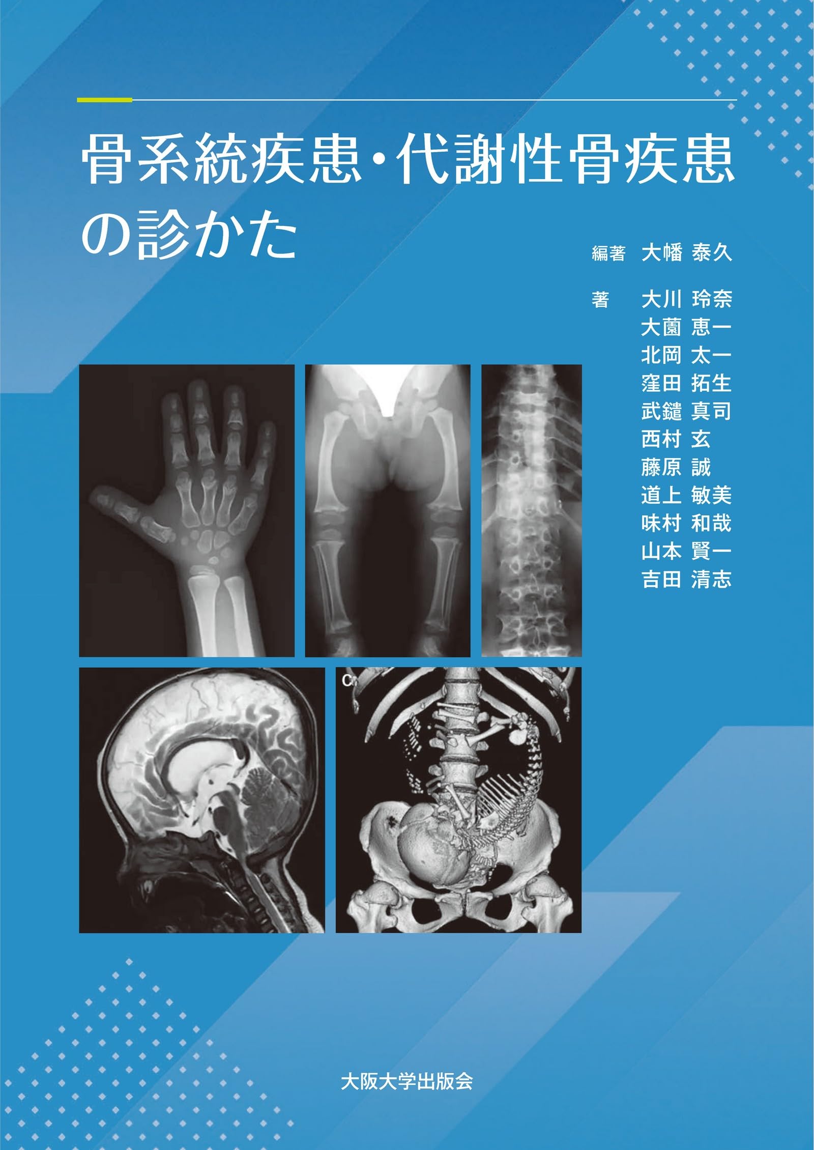 【希少・美品】改訂版 骨の病気と付き合うには（メディカルレビュー社） 骨系統疾患・代謝性骨疾患の診かた | 大幡泰久, 大川玲奈, 大薗恵一