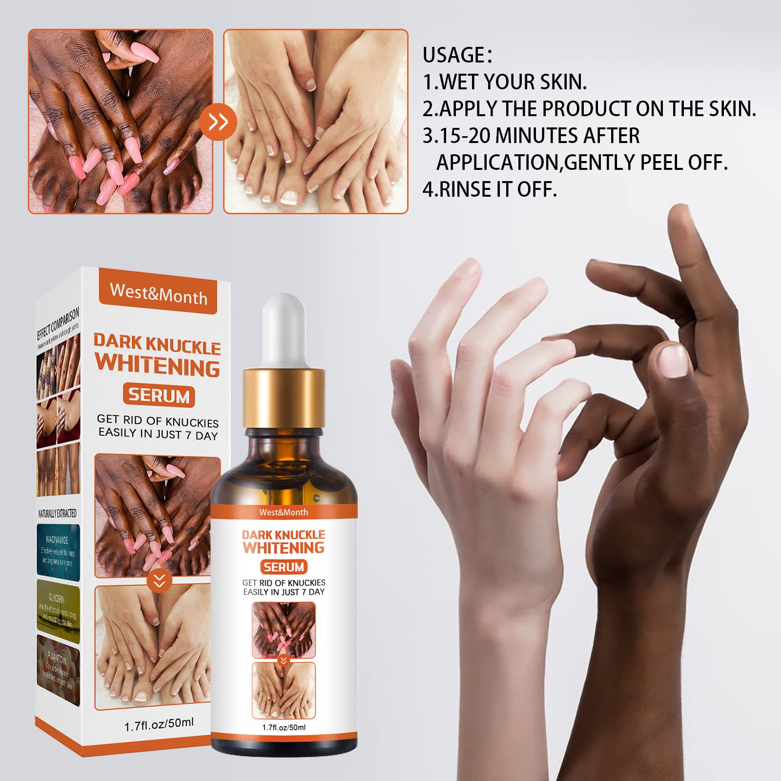 Extra Strength Dark Knuckle Remover Serum Lightening Hands Knuckle Extra Strength Dark Knuckle Remover Serum Lightening Hands Knuckle
