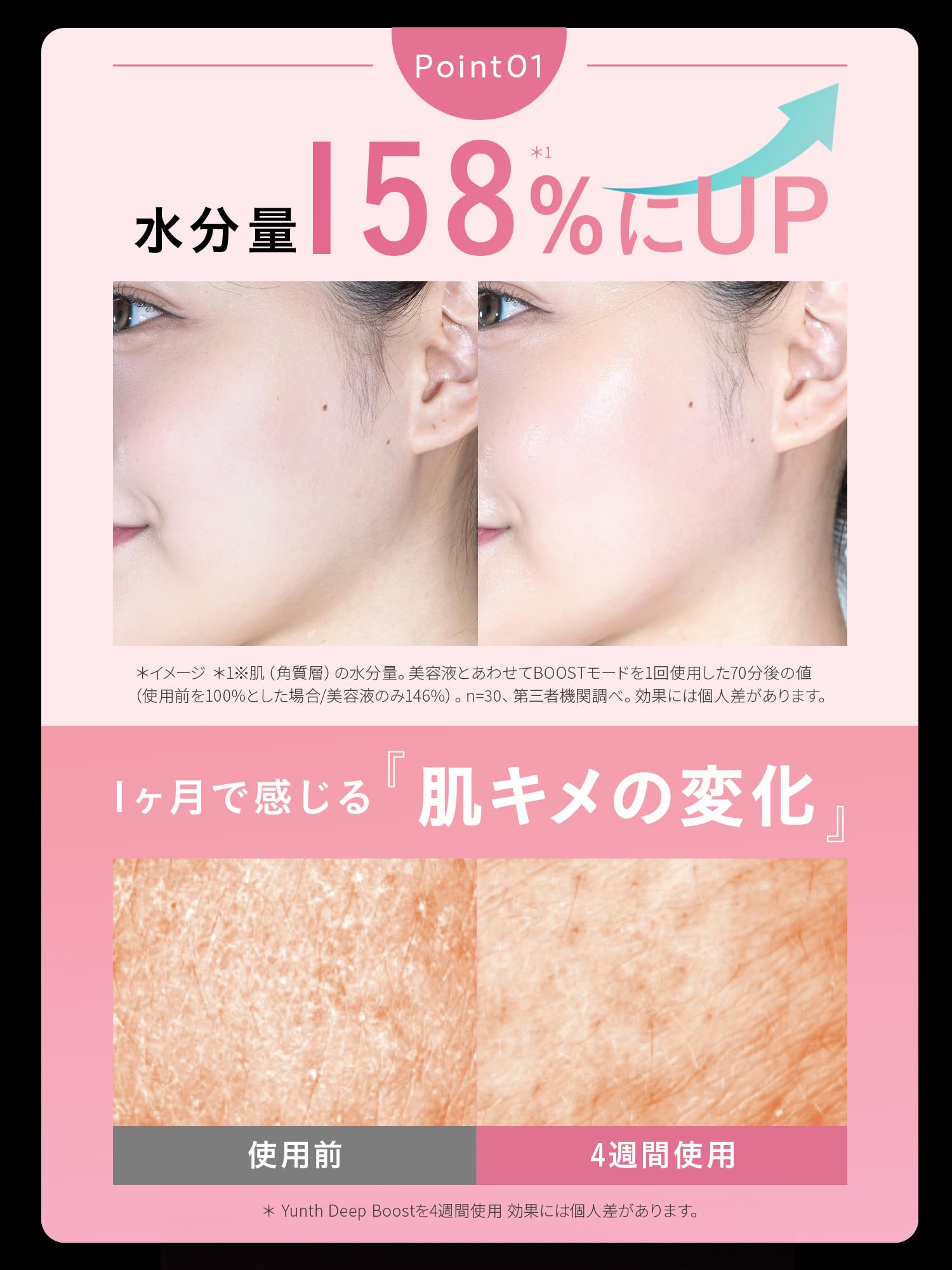 Amazon.co.jp: Yunth ユンス Deep Boost PINK ピンク 美顔器 浸透*1型