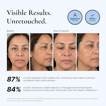 EnaSkin Dark Spot Corrector & Remover Serum for Face & Body, Niacinamide