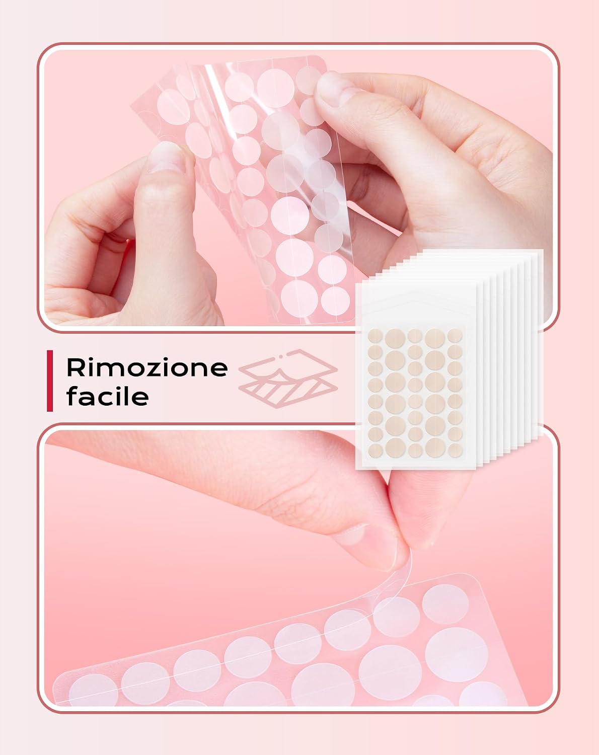 “Patch Brufoli Invisibili – Idrocolloide, Impermeabili e Traspiranti, Assorbimento Efficace per Acne – 360 Pezzi (10mm & 12mm)” - 2