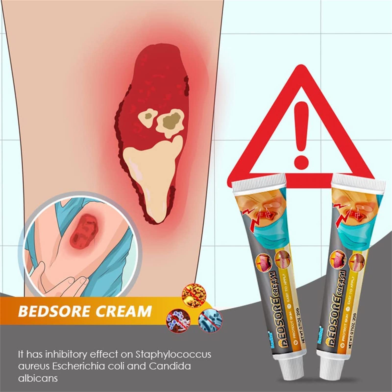 Krem do leczenia bólu łóżka, organiczny odleżyn, maść, odleżyna, krem łagodzący ból odleżyn, pielęgnacja ran w leczeniu odleżyn, leczenie odleżyn, gojenie się ran