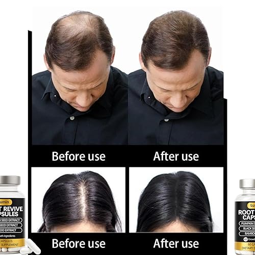 Miniatura 5 de Cápsulas Lumin Root Revive  Suplemento de apoyo capilar para cabello fino, cuero cabelludo saludable y grosor  Con biotina, semilla negra, bambú,
