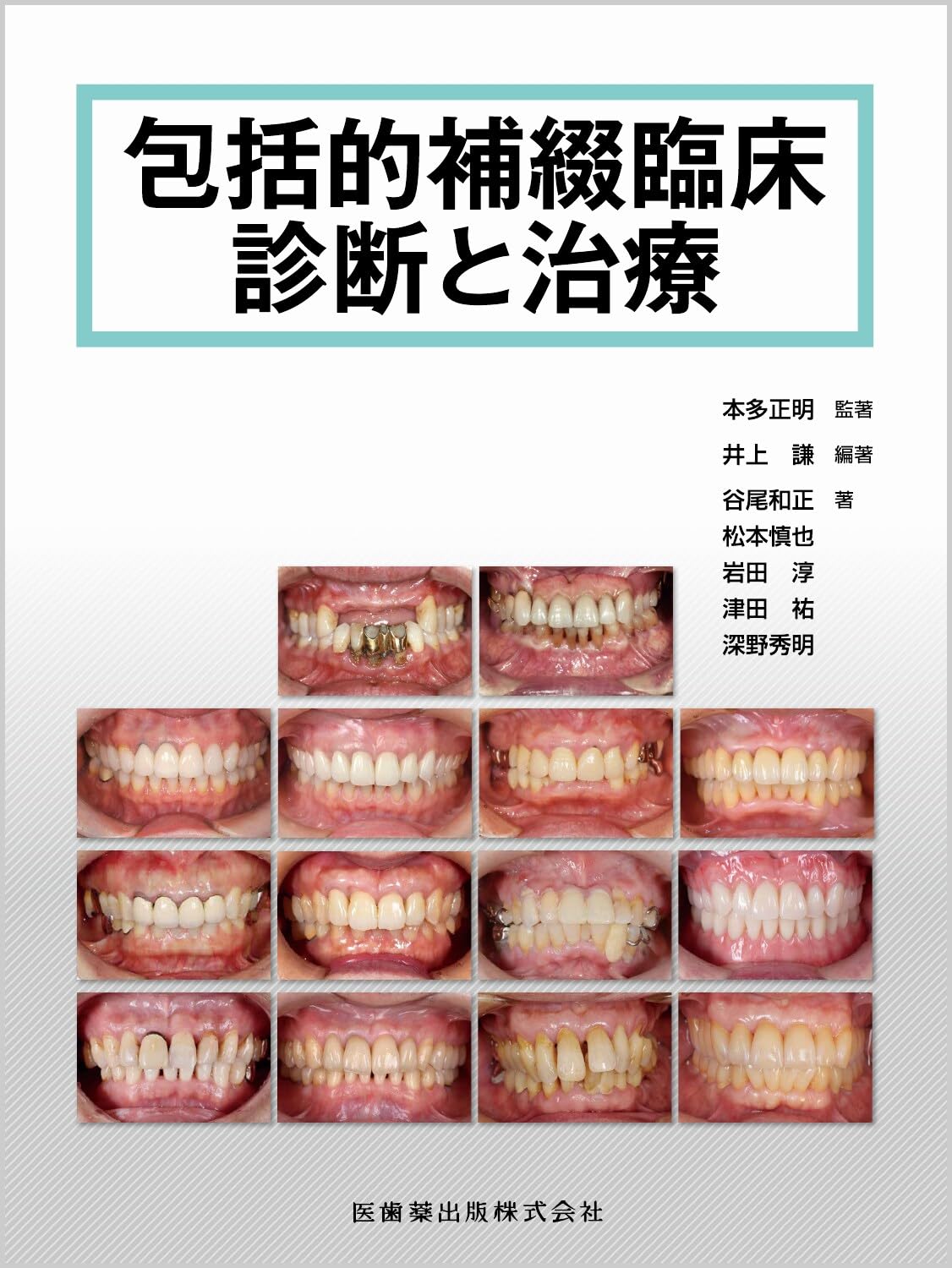 包括的補綴臨床診断と治療 | 本多 正明, 井上 謙, 谷尾 和正, 松本