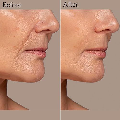 Miniatura 7 de Cara, arrugas de ojos, parches de arrugas en la frente para la cara durante la noche - 72 piezas