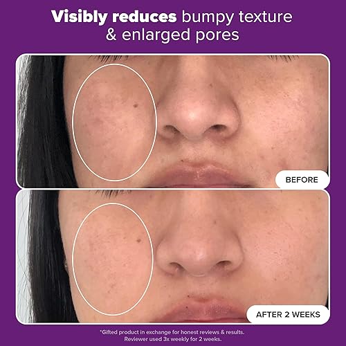 Miniatura 4 de Paula's Choice CLINICAL - Suero concentrado con 20% de niacinamida y vitamina B3, tratamiento antienvejecimiento para decoloración y minimizar los