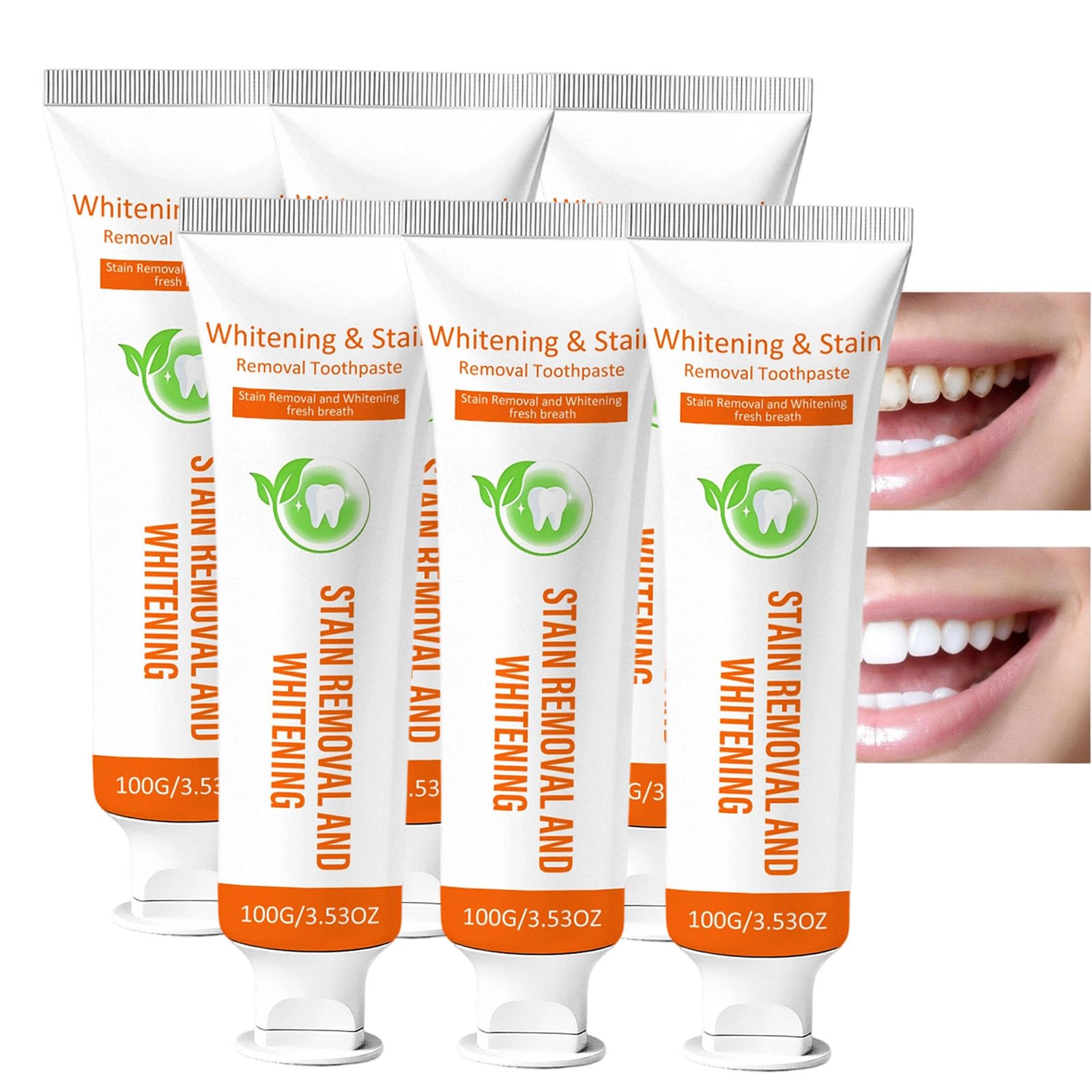 Cavity Healing Tooth Armor + dentifricio per la pulizia profonda + dentifricio + dentifricio sbiancante senza fluoro + dentifricio Sensitivity Relief & Whitening (6 pezzi)