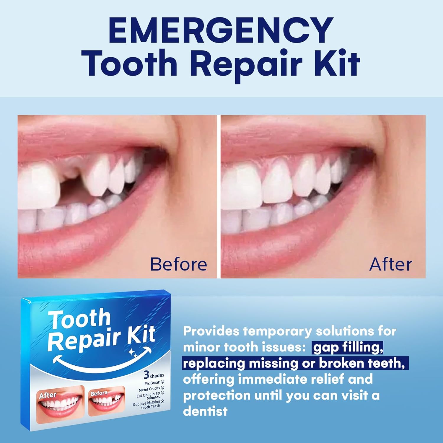 Temporary Tooth Repair Kit: Missing Tooth Replacement Kit Replace Missing or Broken Tooth Filling The Gap - Moldable False Teeth Come with 3 Shades 10 Size