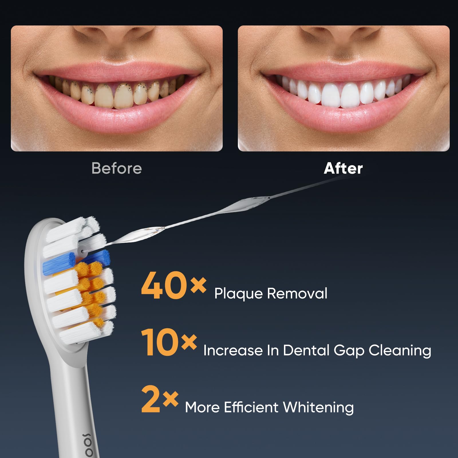 SOOCAS Neos Elektrische Zahnbürste mit Wasserflosser, kabellos, 2-in-1 Bürsten & Flossing Combo Elektrische Zahnbürste für Erwachsene, Eingebauter Wassertank, 40X Reinigungseffekt, 6 Einstellungen