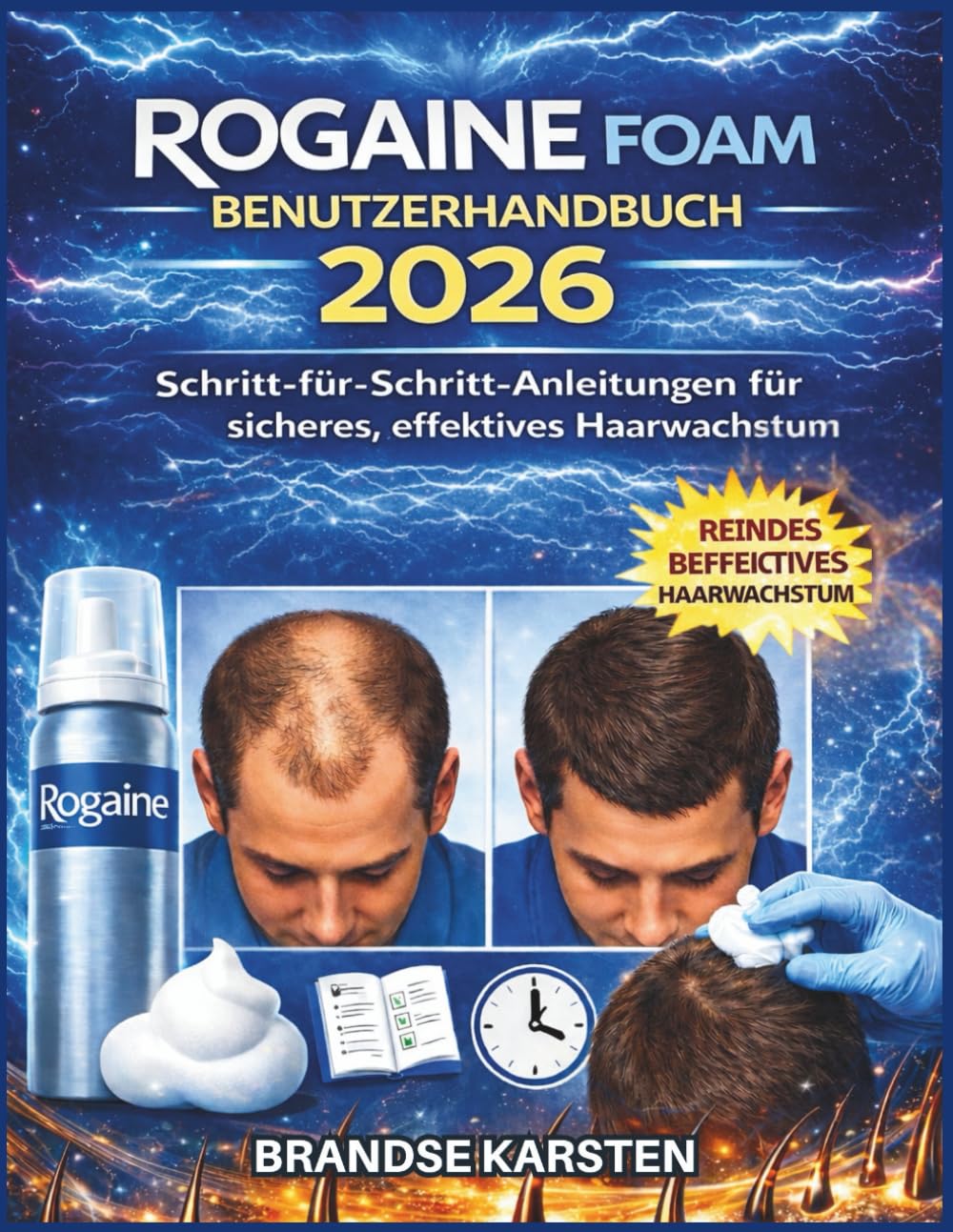 ROGAINE FOAM BENUTZERHANDBUCH 2026: Schritt-für-Schritt-Anleitungen für sicheres, effektives Haarwachstum