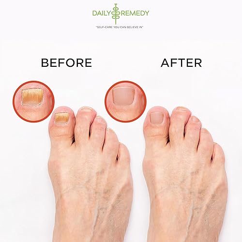 Miniatura 26 de Aceite de árbol de té para pies con sal de Epsom, fabricado en Estados Unidos, 16 onzas