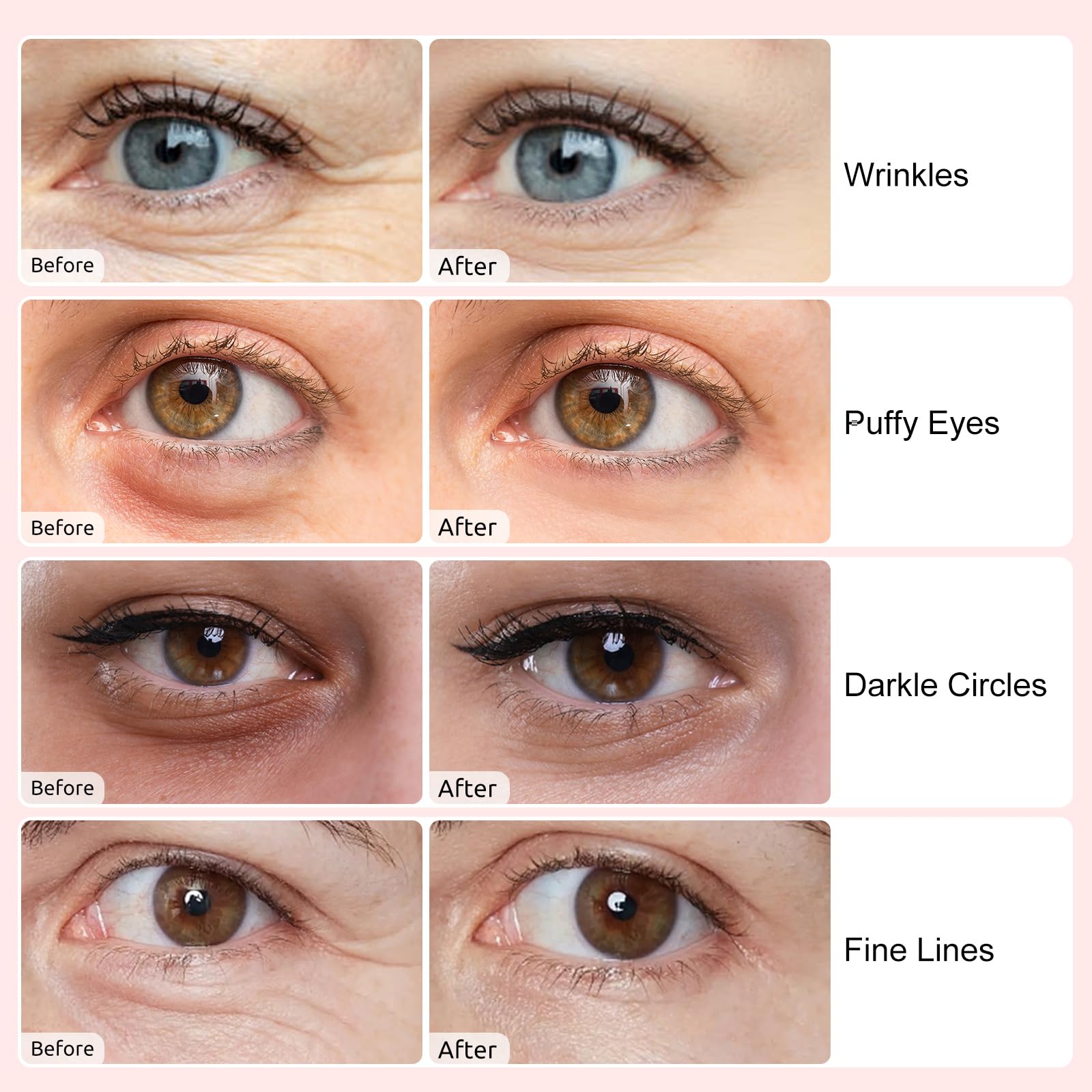 40 pares de parches debajo de los ojos para ojeras, ojos hinchados, arrugas, máscara de ojos de cristal de colágeno con ácido hialurónico, bolsas debajo de los ojos tratamiento para el 4