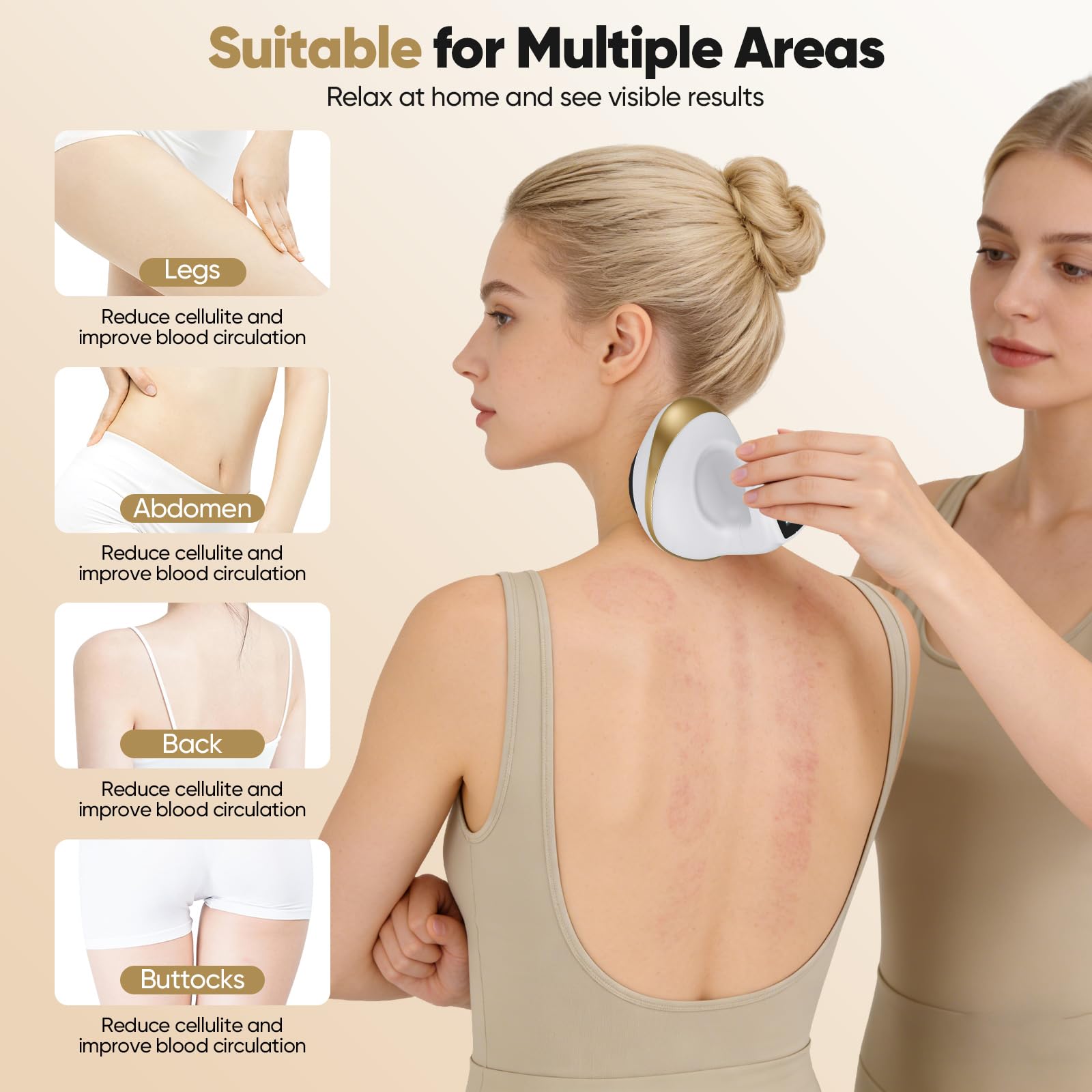 Massaggiatore Contro Cellulite 4 In 1,9 Potenza Di Aspirazione E 9 Calore, Con Coppettazione Sottovuoto E Gua Sha Elettrico, Massaggiatore Anticellulite Vacuum Favoriscono La Circolazione Sanguigna
