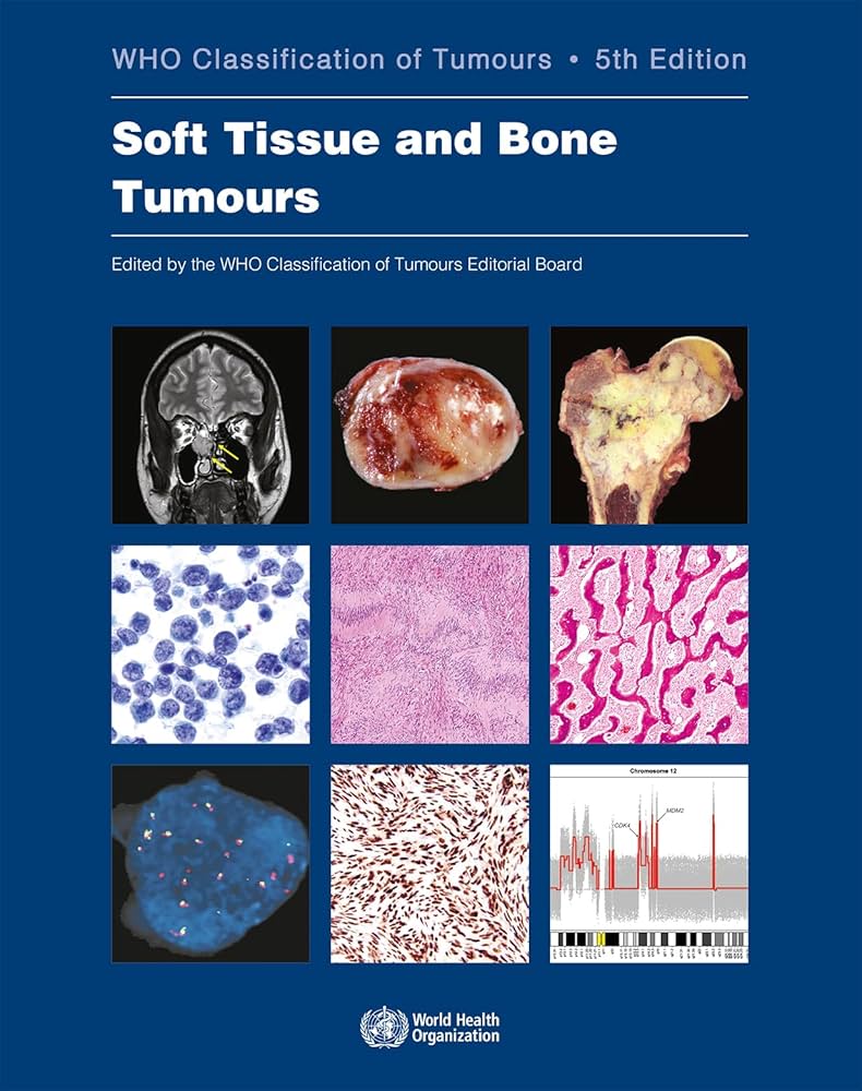 WHO classification of tumours of soft tissue and bone tumours: 3