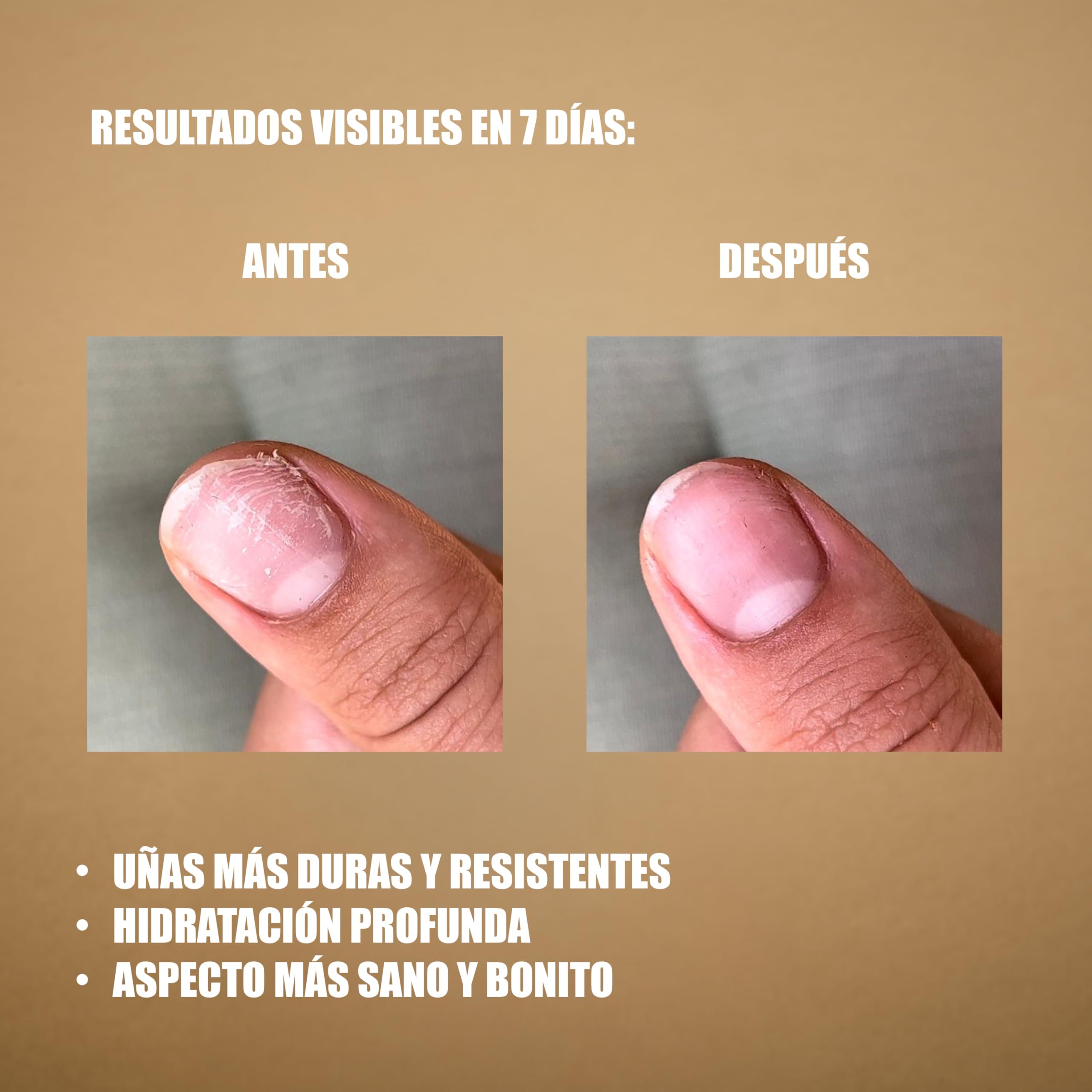 Gel reparador y fortalecedor de uñas y cutículas | Resultados en 7 días | Hidrata, endurece y da brillo | Eficaz con o sin esmalte | 3 ml