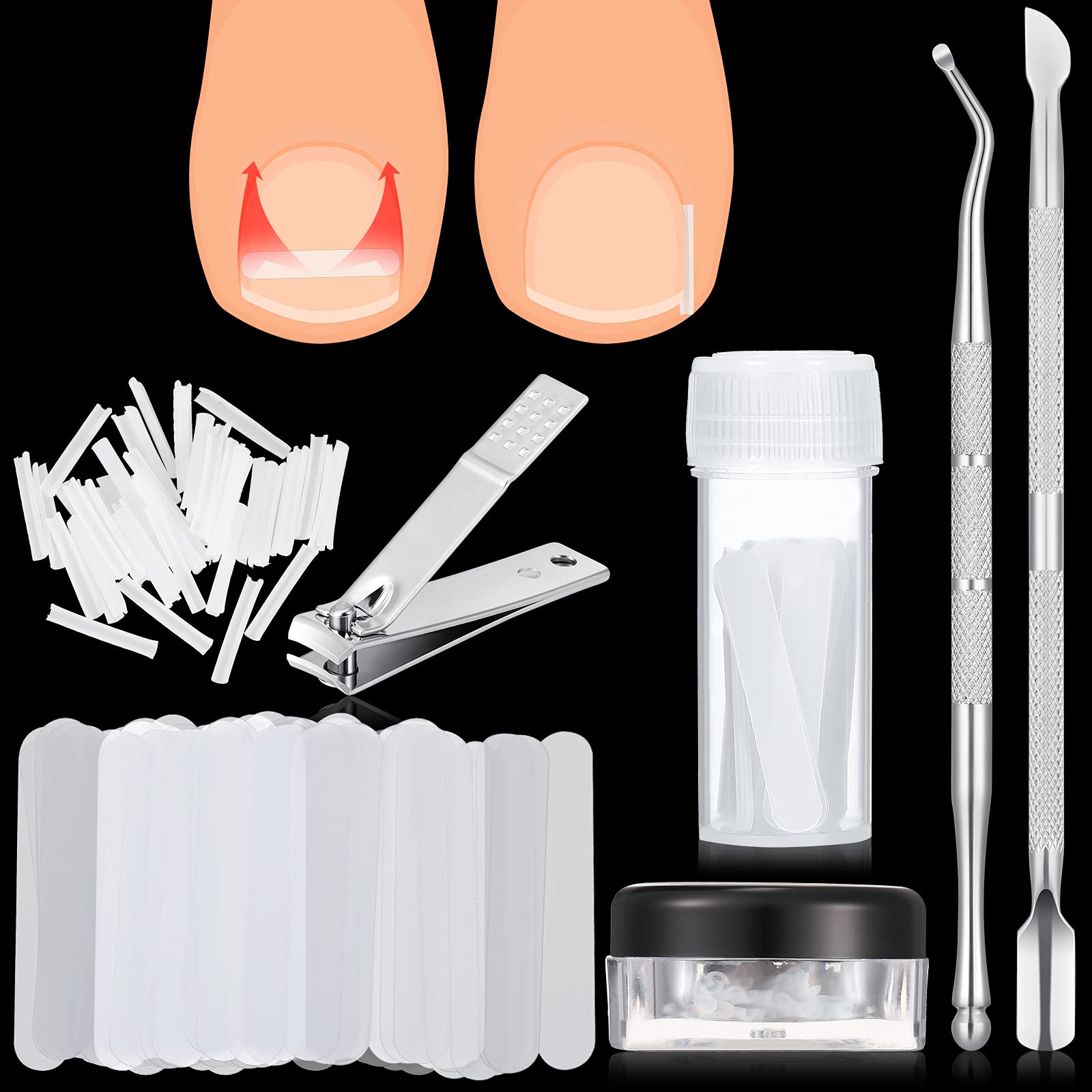 Buy 100 Pieces Ingrown Toenail Corrector Strips Ingrown Toenail