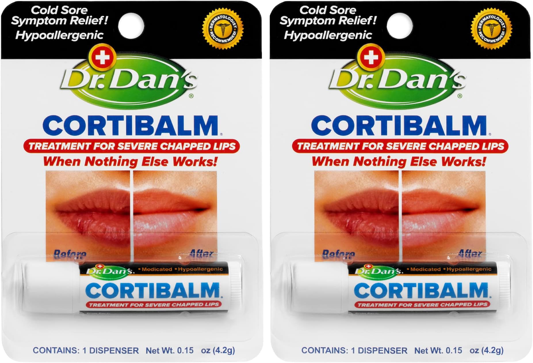 Dr. Dan's Cortibalm- 2 Pack- for Severe Chapped Lips and Cold Sore Relief