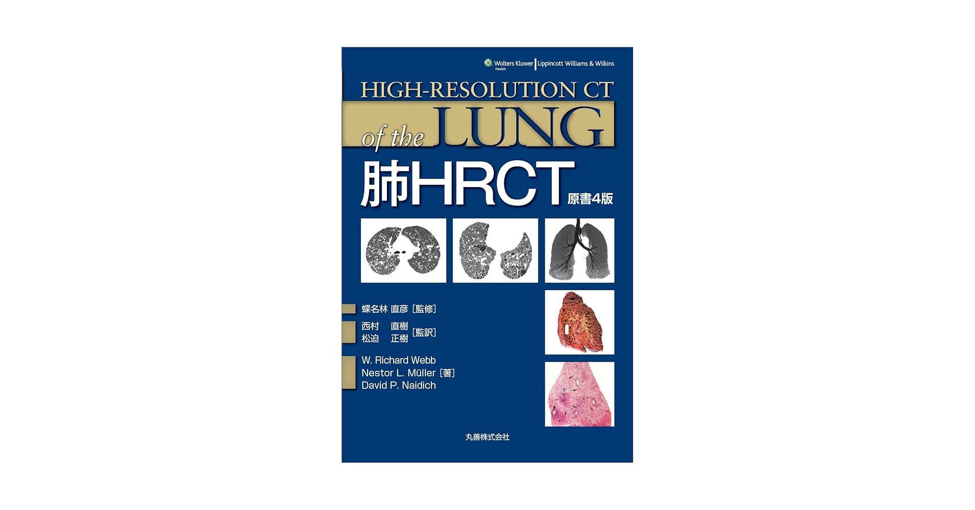 肺HRCT | W.Richard Webb, Nestor L. Muller, David P. Naidich