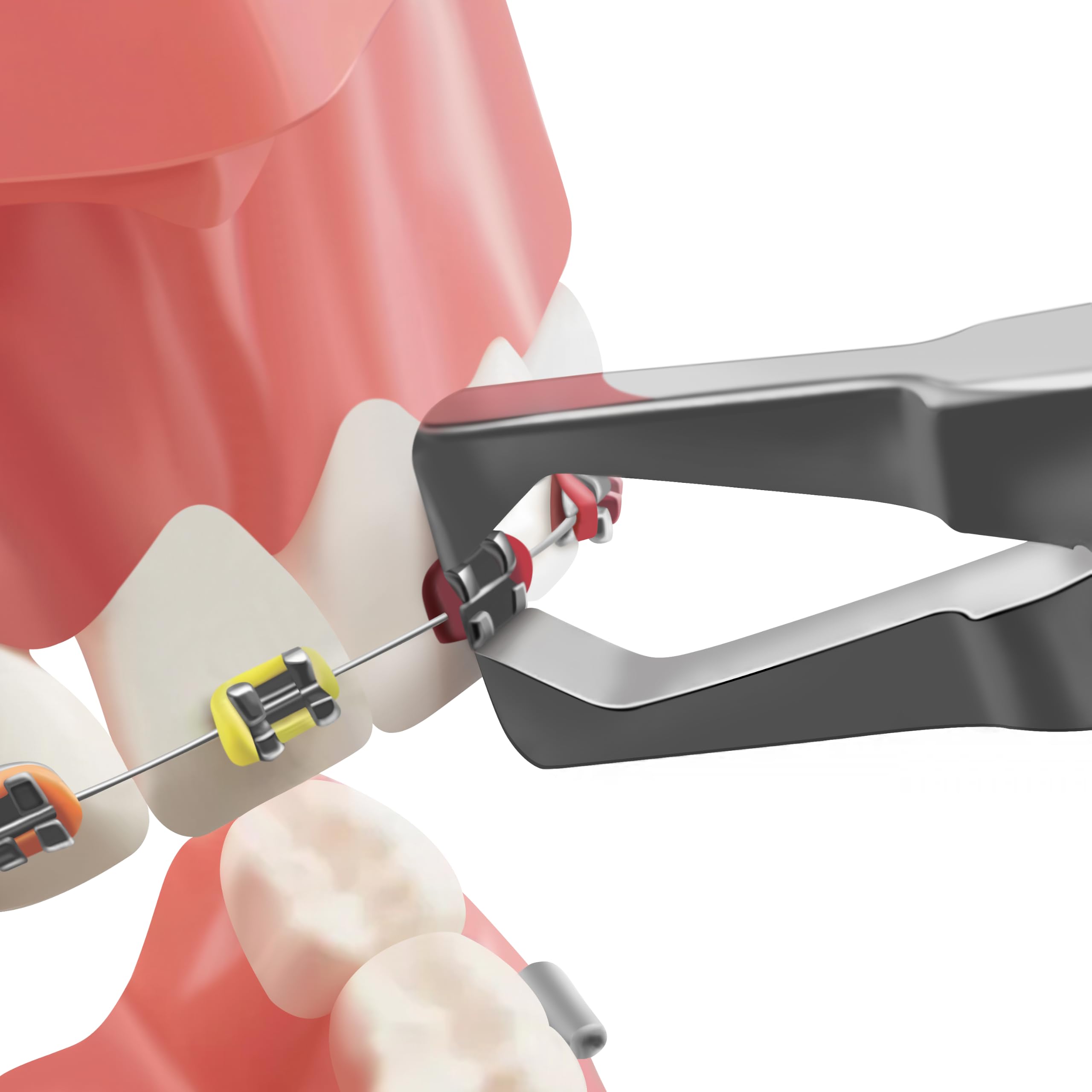 Orthodontic Pliers - Remove Brackets Fast -7