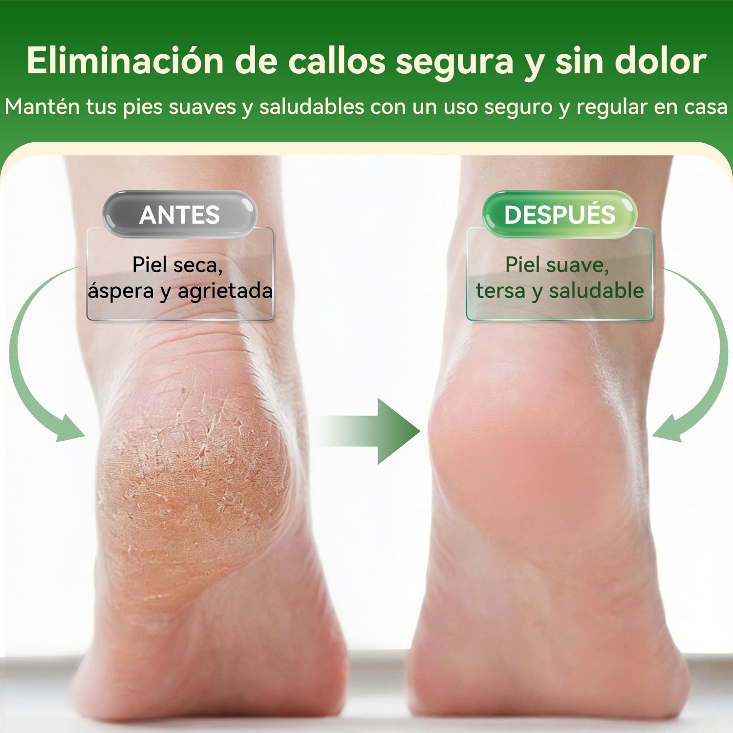 SHORAN Lima Electrica Pies Durezas, Pedicura Profesional Quita Durezas Electrico, Maquina pies para Exfoliante Eliminar Durezas y Callos, Lima Pie Durezas Recargable con 2 rascador pies e 3 Rodillos