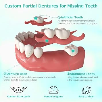 Custom Partial Denture for Missing Tooth with Impression Kit (1 Tooth)