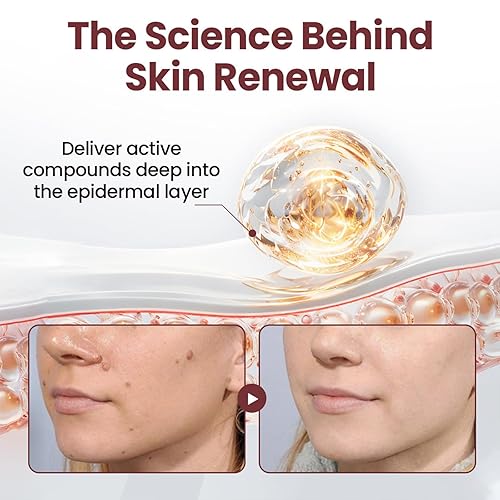 Miniatura 4 de Biancat KeraErase Crema renovadora de doble acción, crema profesional de tratamiento de la piel, crema reparadora calmante de arroz blanco y negro,