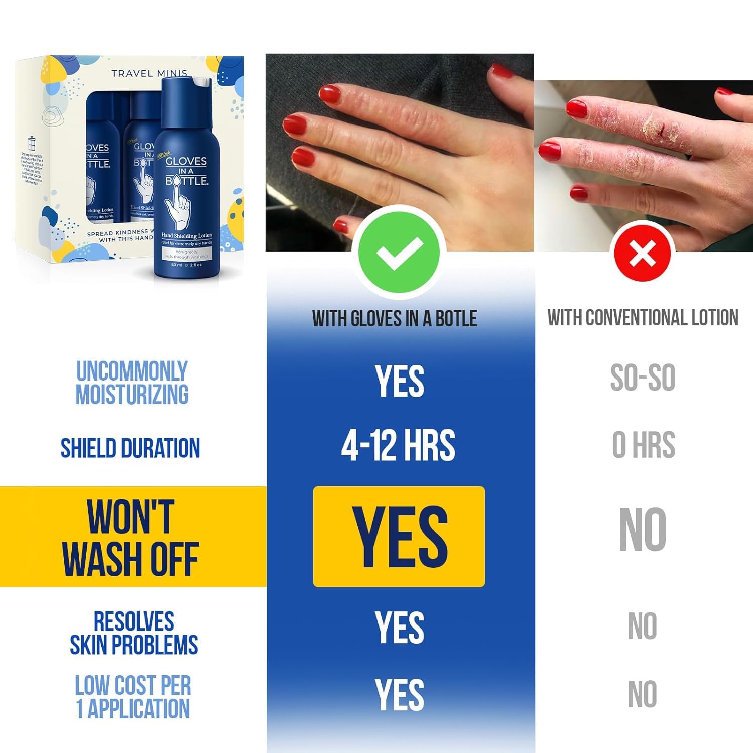 Gloves In A Bottle Psoriasis Eczema Relief Hand Lotion Travel Size - Shielding Lotion for Women, Men, 6 months old or older babies - Cracked Hands Repair Cream (2 Oz + 16 Oz) image 5
