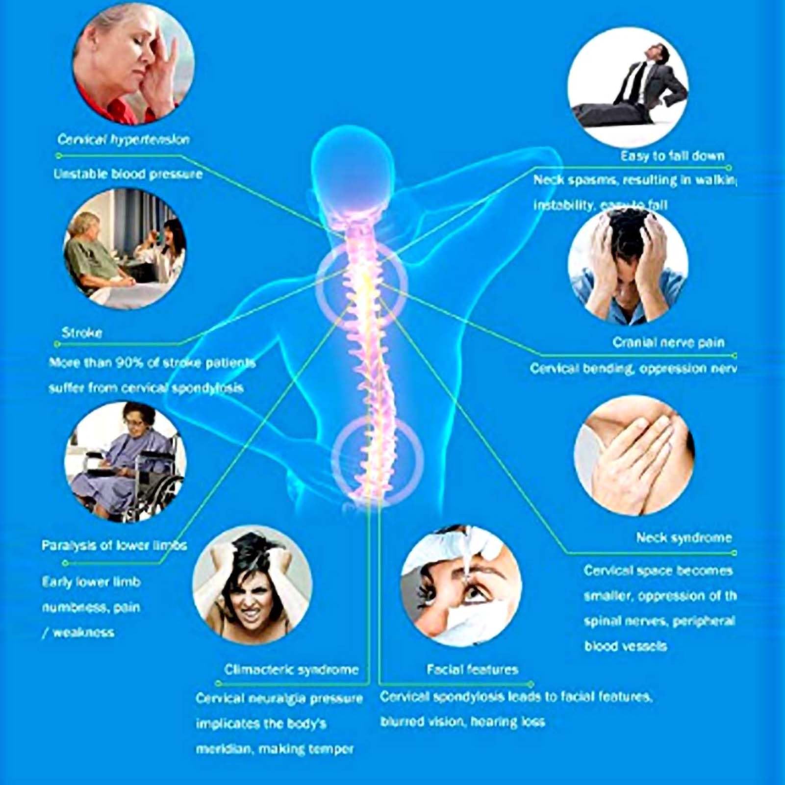 Collare Cervicale, Dispositivo di Trazione Cervicale Regolabile Neck Corrector Strumento per Recuperare la Cura del Collo del Collare Rivivere il Dolore al Collo