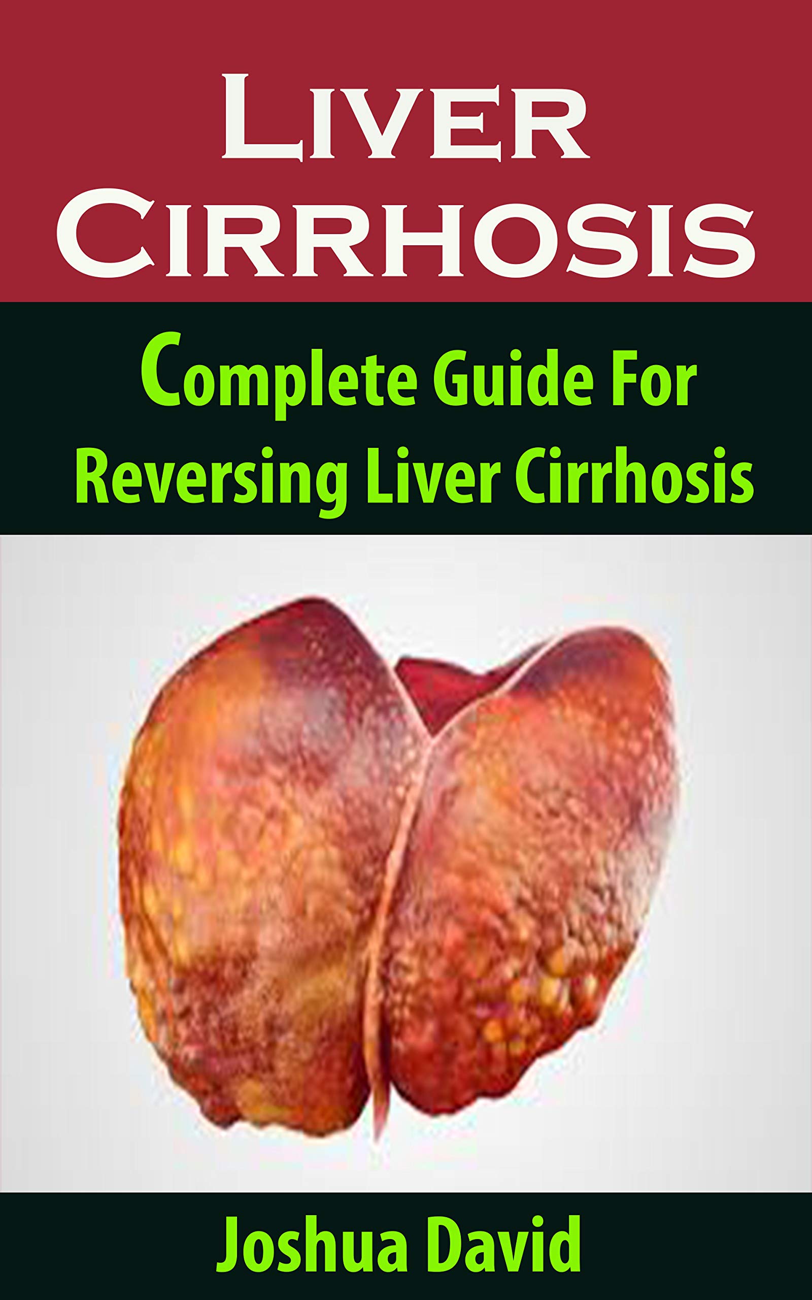 Liver Cirrhosis: Liver Cirrhosis: Complete Guide For Reversing Liver Cirrhosis