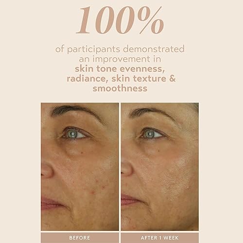 Miniatura 5 de SHANI DARDEN SKIN CARE Retinol Reform con suero de retinol encapsulado al 1% para cara y cuello, suero facial suave de liberación lenta con