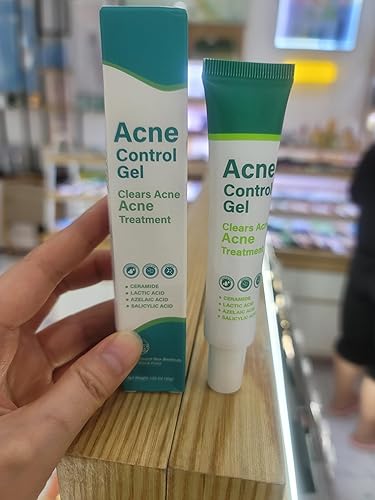 Suero de ácido azelaico al 10%, gel de tratamiento para el acné con ácido salicílico, para el control del acné, reduce el enrojecimiento, previene