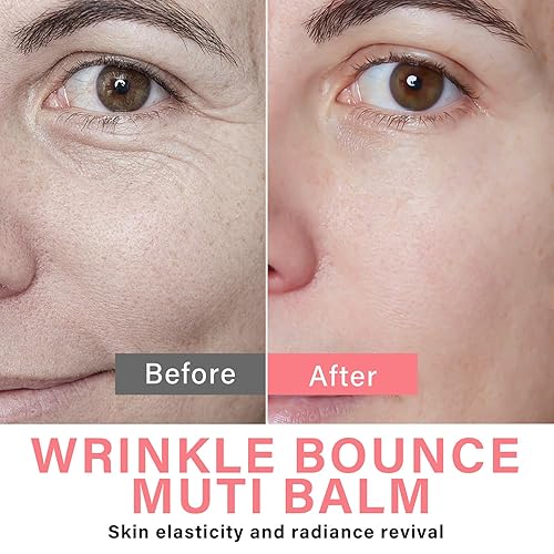 Miniatura 7 de Topkech Barra de bálsamo múltiple para hidratante facial, bálsamo múltiple de rebote de arrugas, reduce eficazmente las líneas finas y la