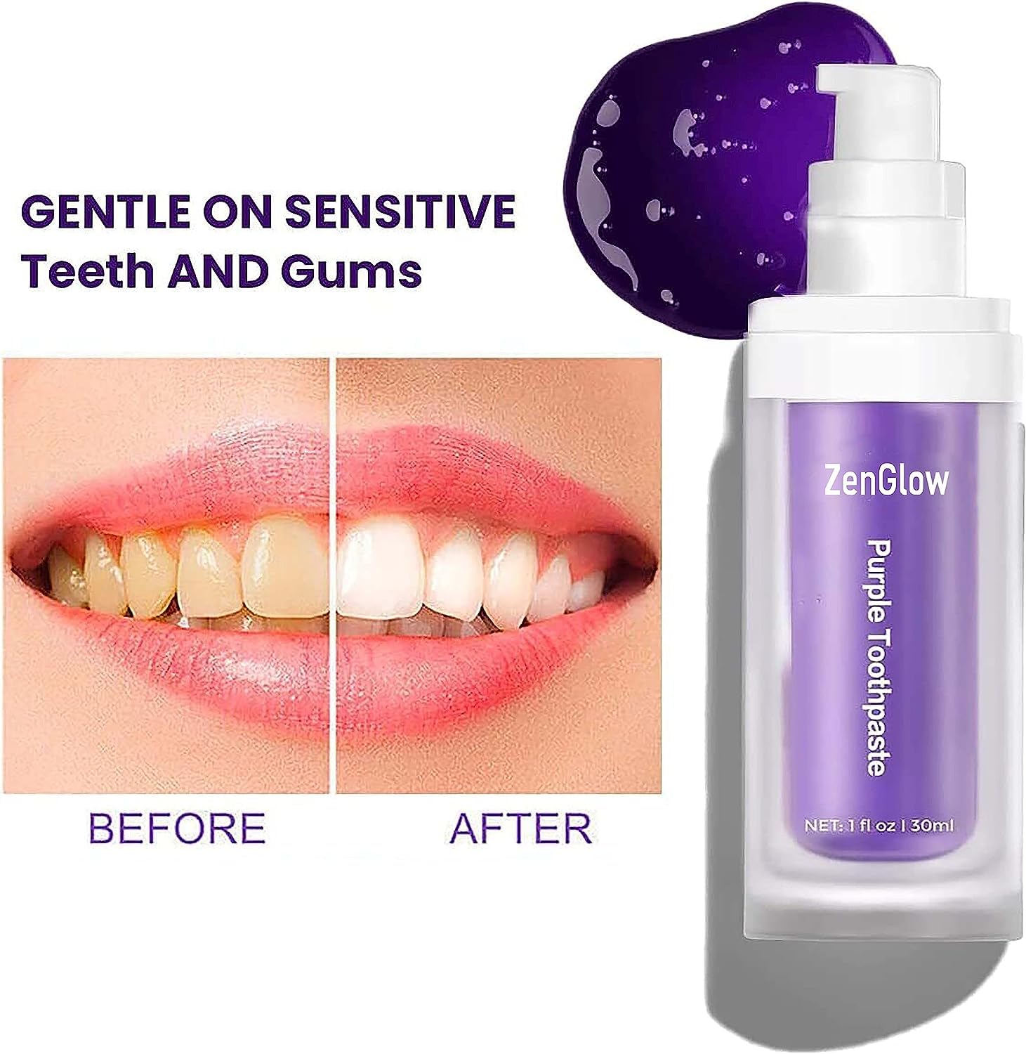 Zenglow Purple Teeth Whitening, Teeth Whitening Booster,Tooth Stain Removal, Purple Toothpaste, ZenGlow,Colour Corrector, Tooth Colour Corrector