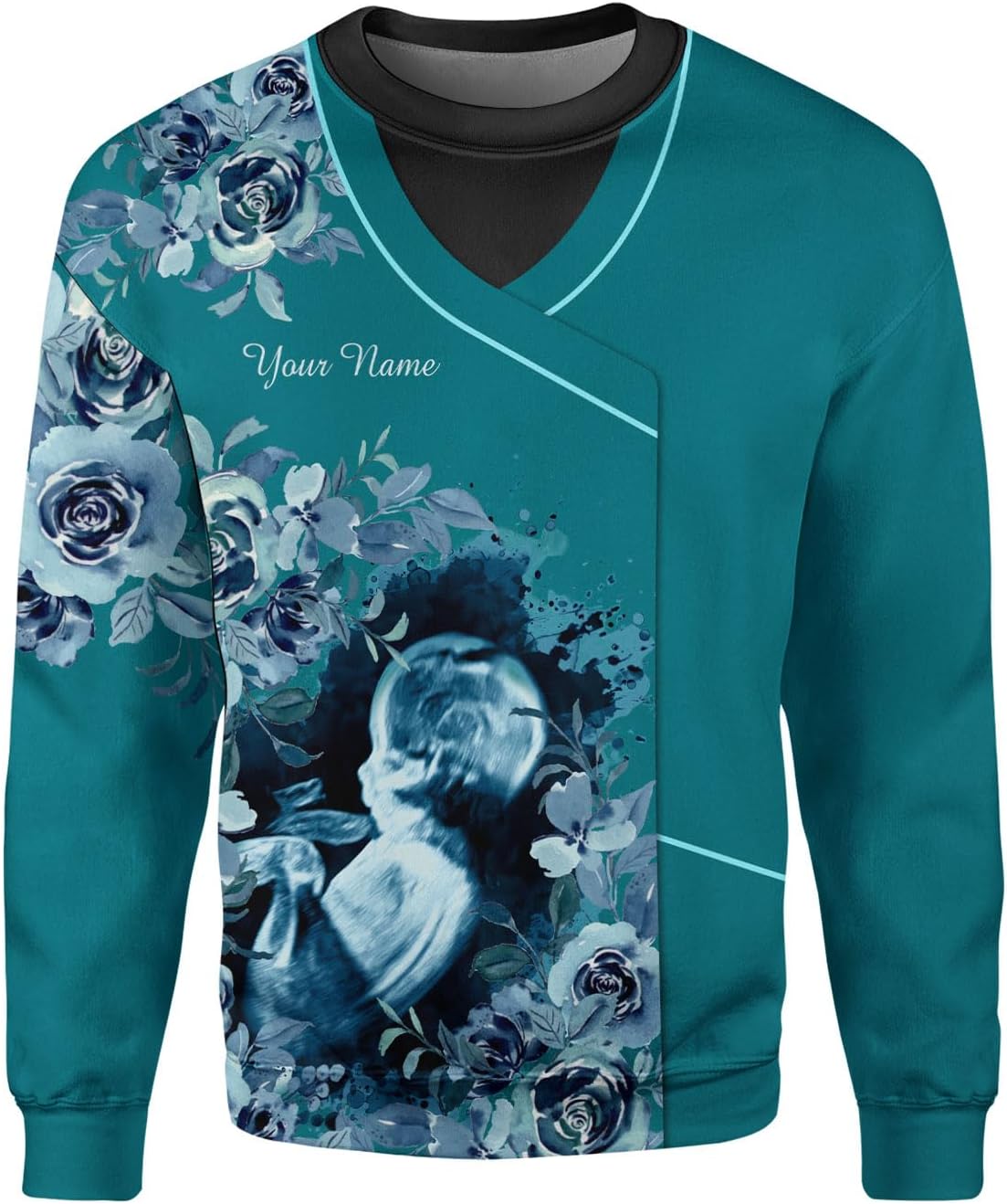 Custom Sonographer Shirt for Men Women, Personalized Ultrasound Tech Shirts for Sonography Technician Gifts Sonographers