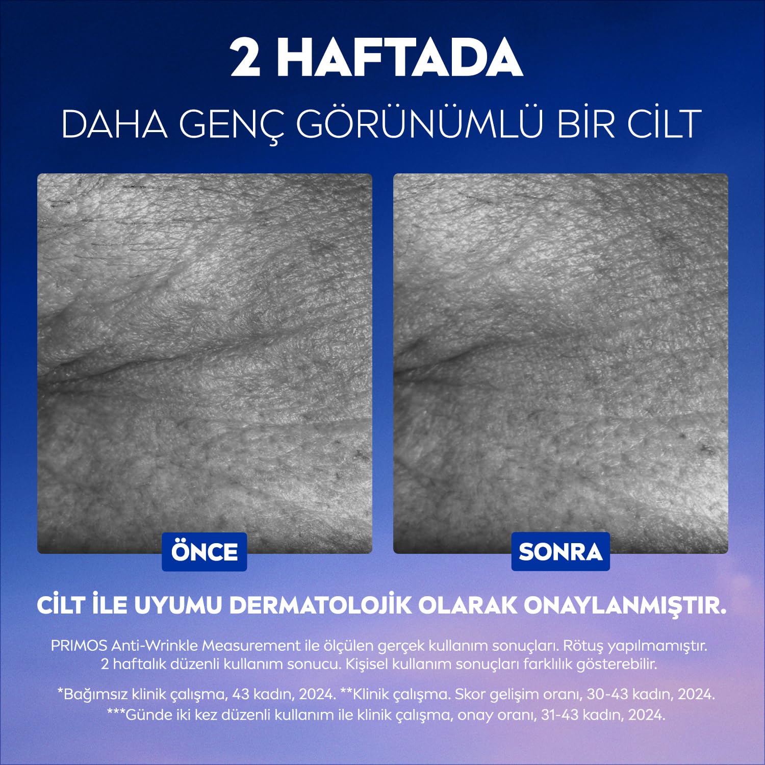 NIVEA Cellular Epigenetics Rejuvenating Yaşlanma Karşıtı Cilt Serumu 30 ml, Dolgunlaştırıcı,Nemlendirici,Sıkıaştırıcı,Hyaluronik Asit