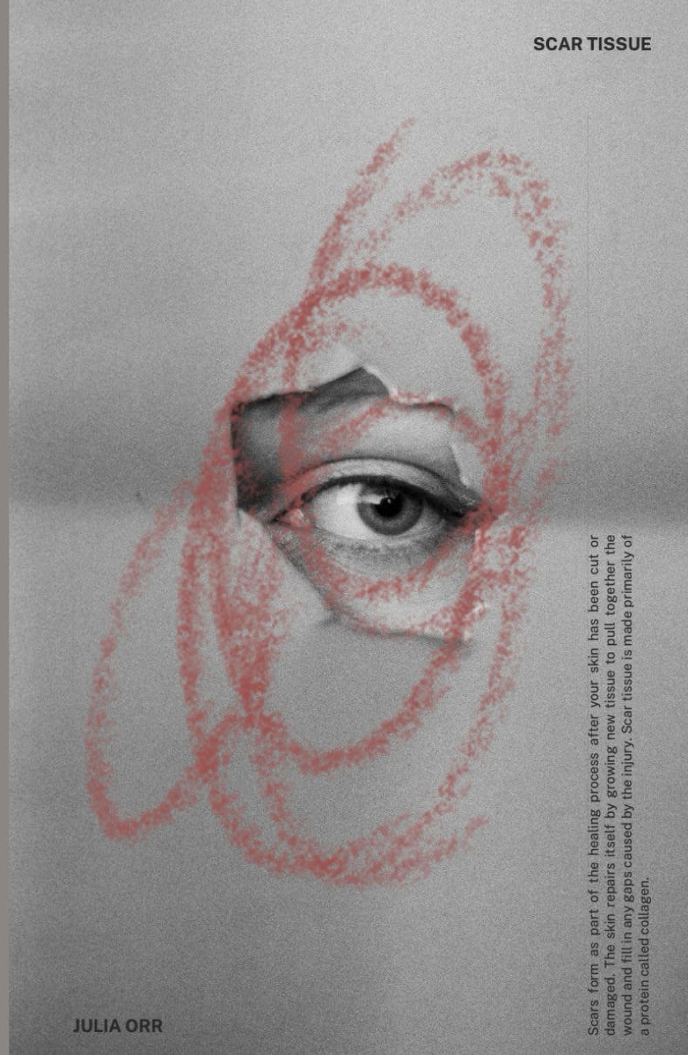 SCAR TISSUE