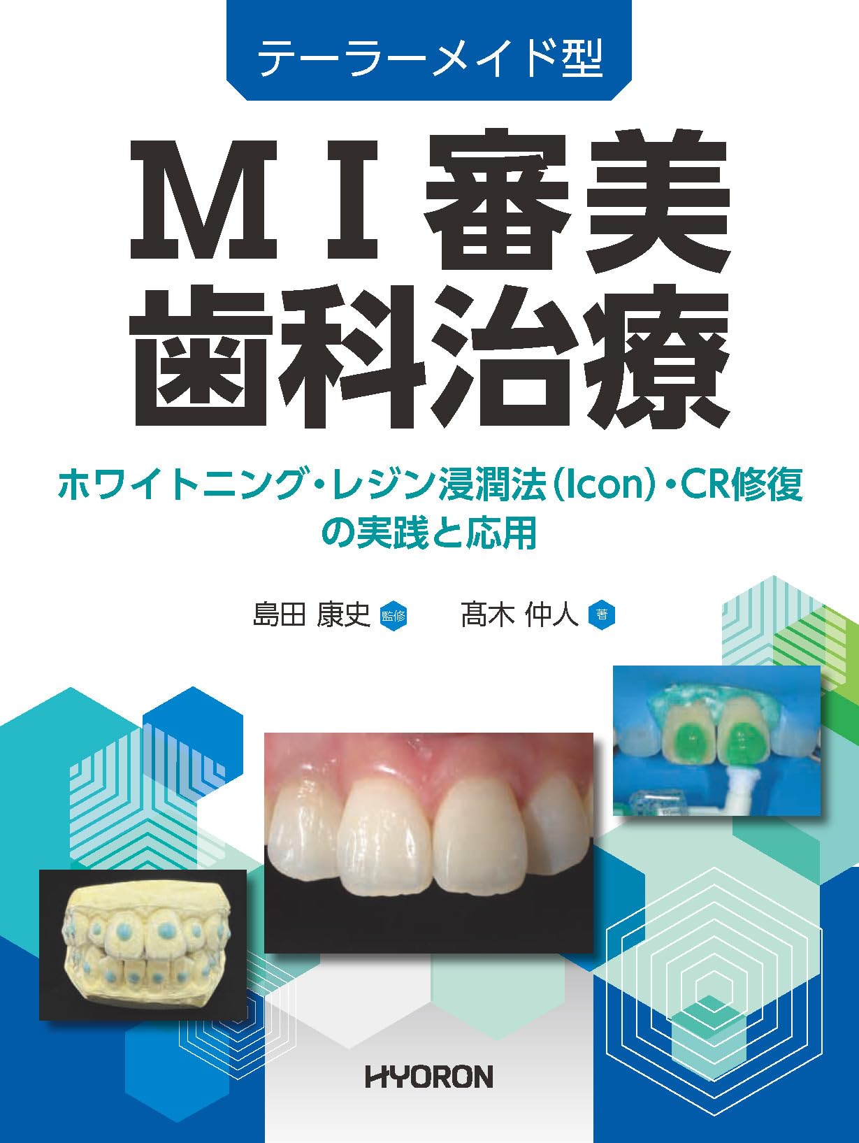 テーラーメイド型 MI審美歯科治療―ホワイトニング・レジン浸潤法（Icon