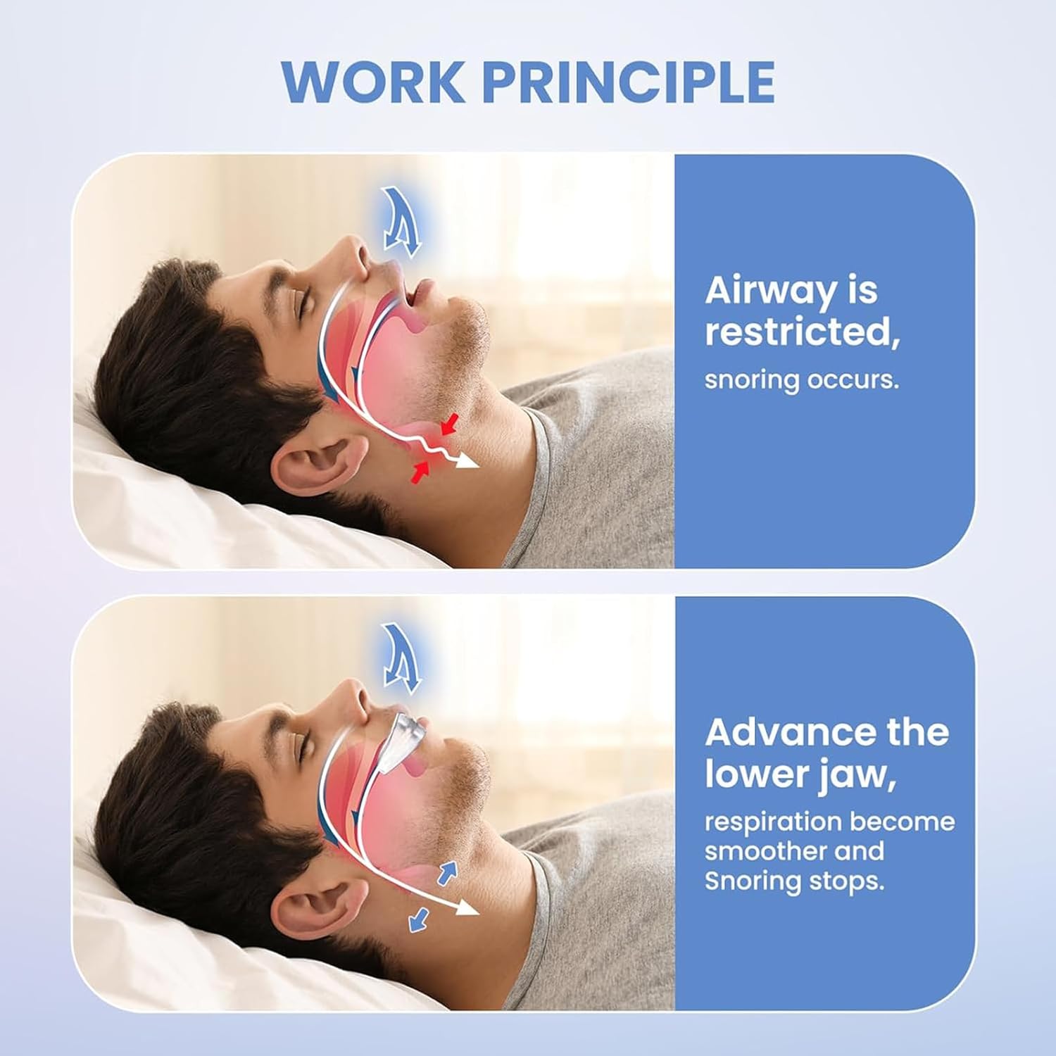 Best Health & Beauty - Snore Mouthguard: Anti Snoring Device Review