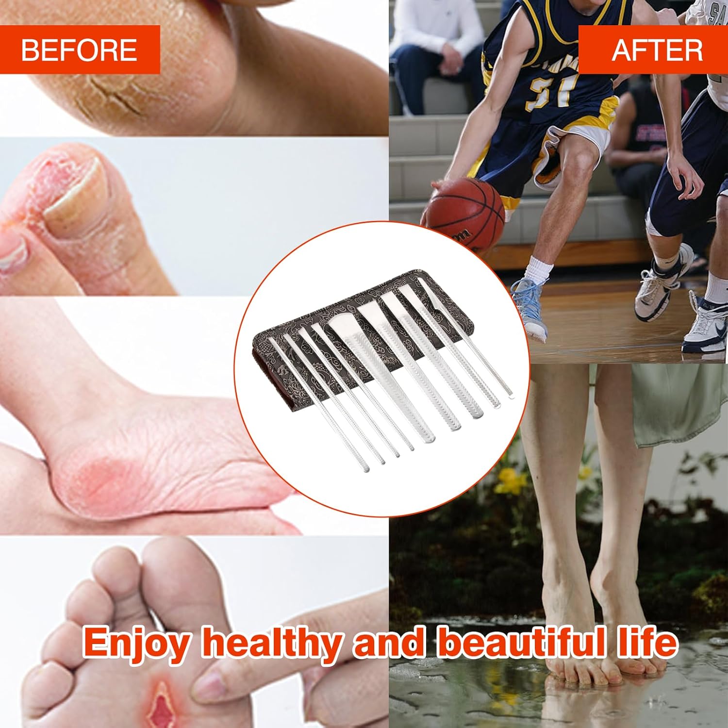 Pedicure Knife Kit 9Pcs, Nail Knives Tools, Foot Care Supplies with Storage Bag