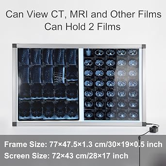 X線フィルムLEDライトボックス 医療機器フィルムビューアー 病院、歯科用X線観察ランプ77x47.5cm/30x19in