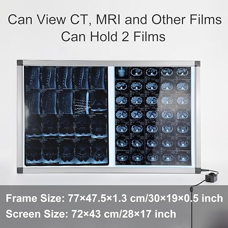 X線フィルムLEDライトボックス 医療機器フィルムビューアー 病院、歯科用X線観察ランプ77x47.5cm/30x19in