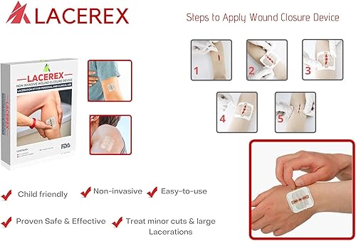 Miniatura 5 de AWD Zip Stitch - Tiras quirúrgicas para cierre de heridas, 2 dispositivos de punto de cremallera, 2 gasas estériles, 2 toallitas con alcohol,