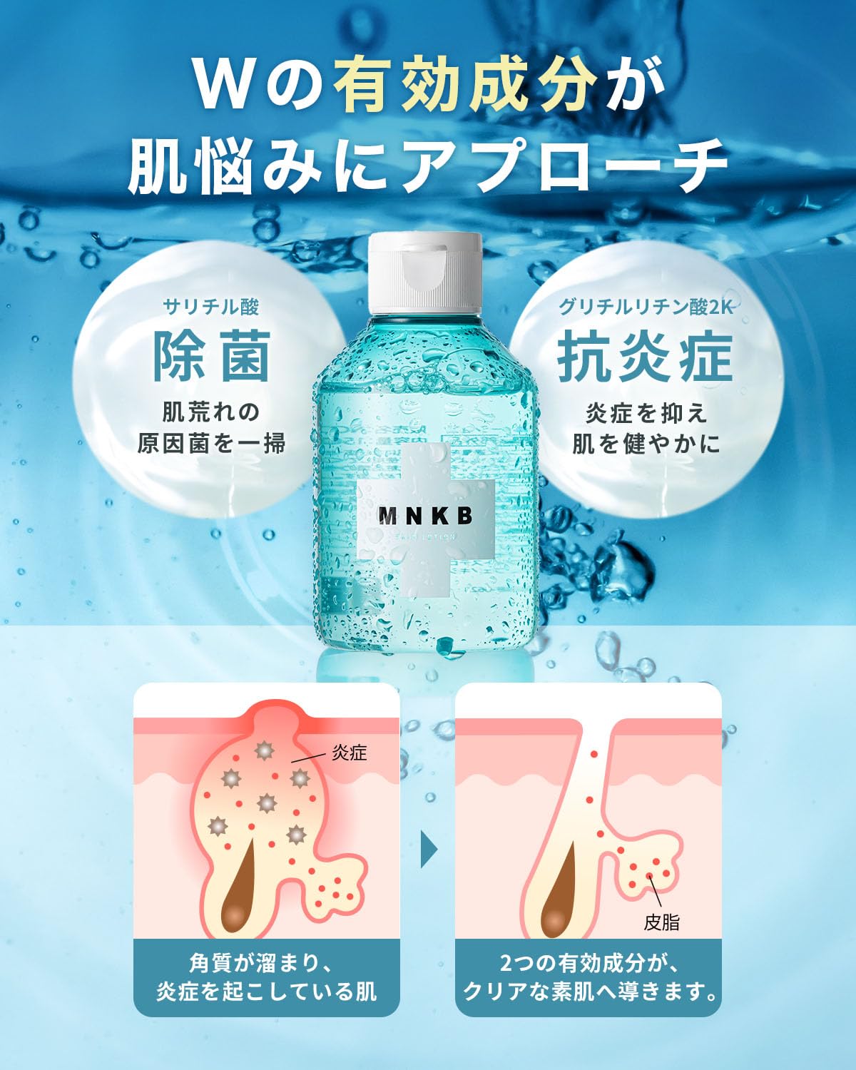 Amazon | MNKB 化粧水 メンズ ニキビ 150ml 医薬部外品 敏感肌 脂性肌 