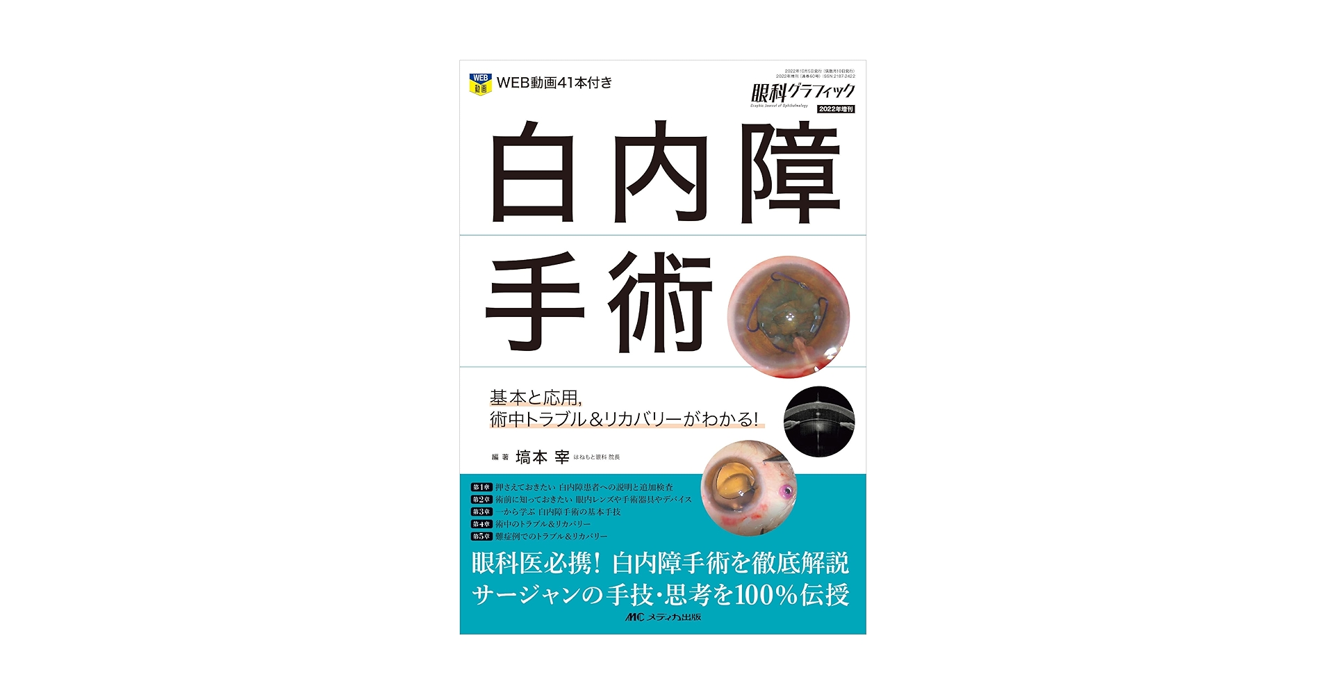 【裁断済み】スタンダード白内障手術 メジカルビュー社｜眼科｜スタンダード白内障手術［Web動画付］