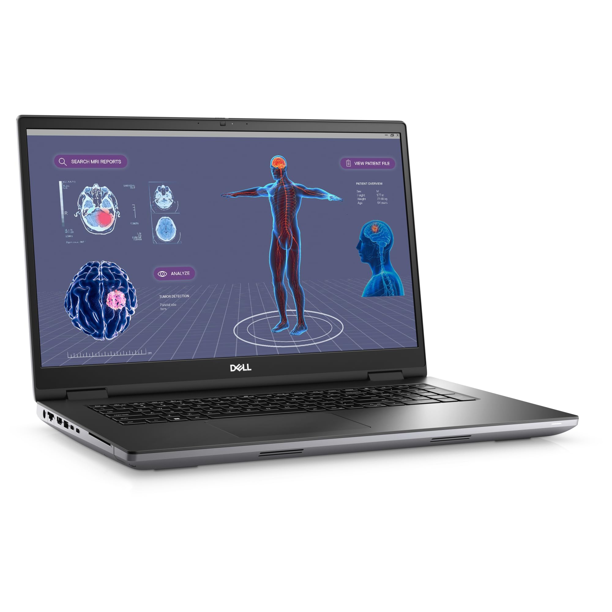 Amazon.com: Dell Precision 7780 Mobile Workstation - 17.3
