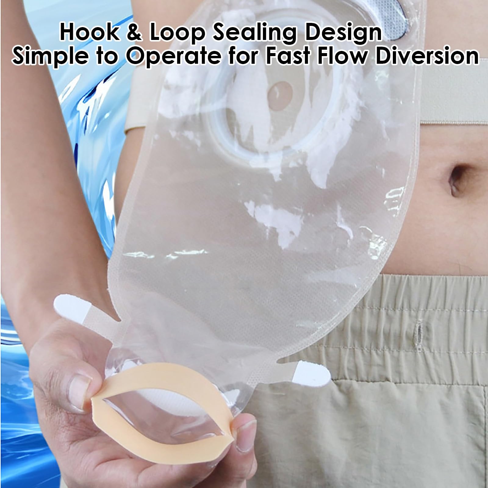 15 Suministros para Ostomía, Bolsas de Colostomía de Dos Piezas, Bolsa de Ostomía Drenable para el Cuidado del Estoma de Ileostomía, Recortable a Medida de 15-60 Mm (10 Bolsas+5 Barreras)
