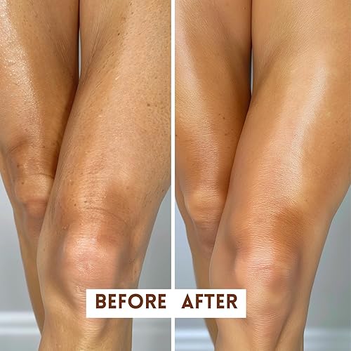 Miniatura 4 de Anti-Edad Tratamiento Corporal  el mejor Tratamiento Anti-Edad para tu cuerpo