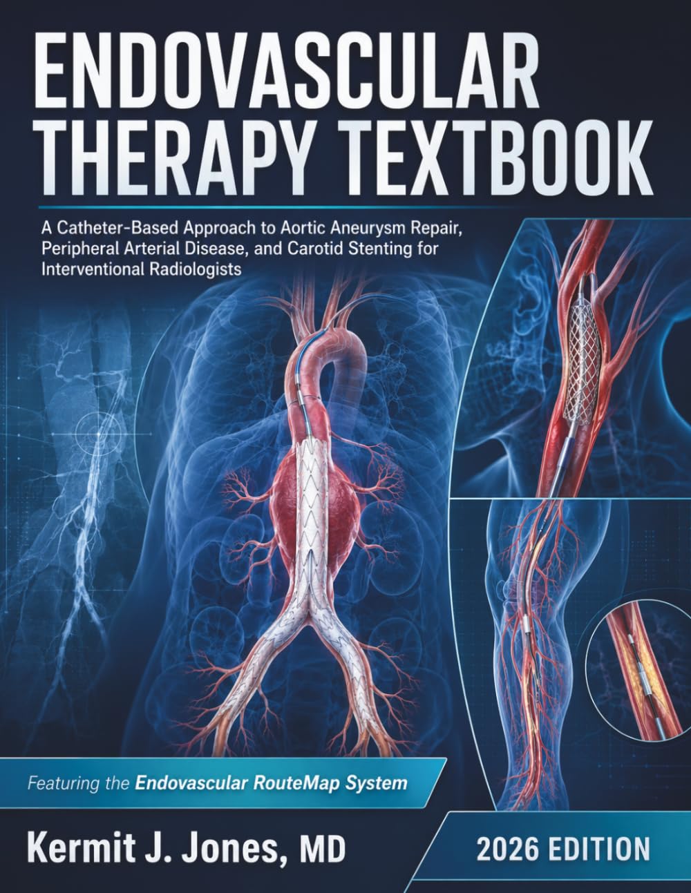 Endovascular Therapy Textbook: A Catheter-Based Approach to Aortic Aneurysm Repair, Peripheral Arterial Disease, and Carotid Stenting for Interventional Radiologists