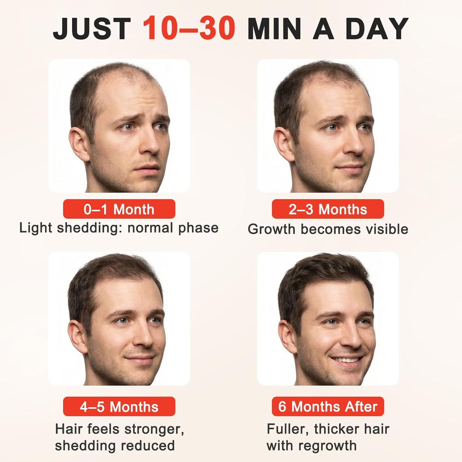 Red Light Therapy for Hair Growth,528 Total Light Emitters,Full-Scalp Coverage,Laser Hair Growth Cap,Blue